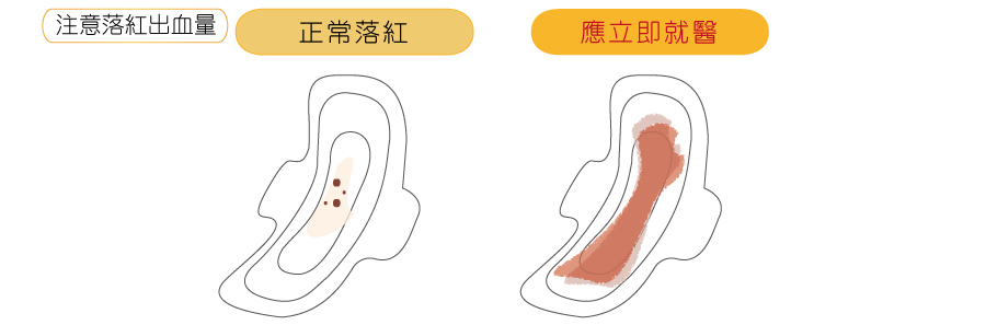 注意落紅出血量