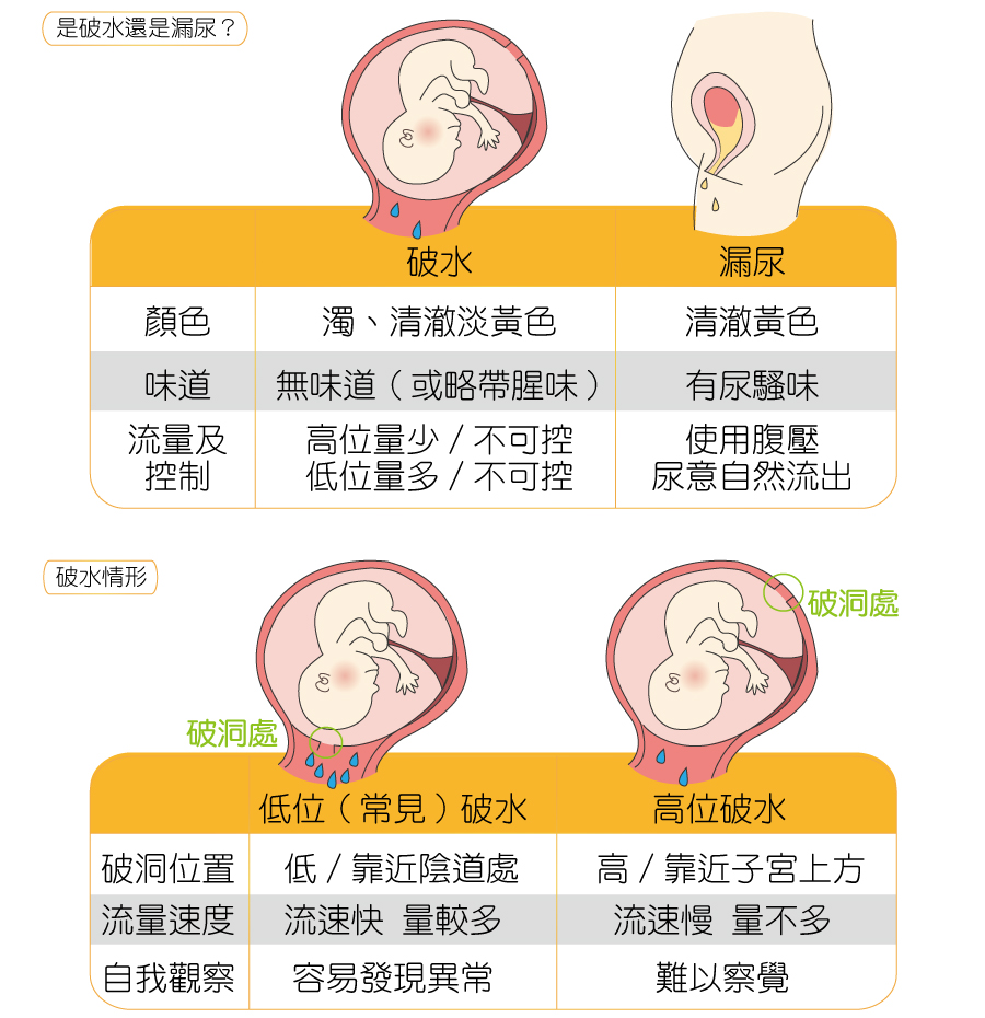 高位破水低位破水