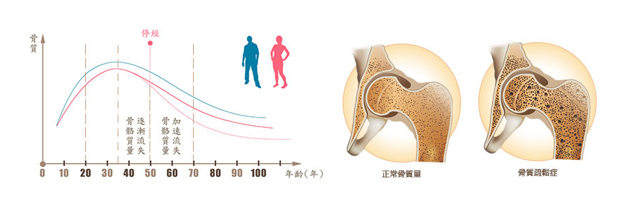骨質年齡狀況
