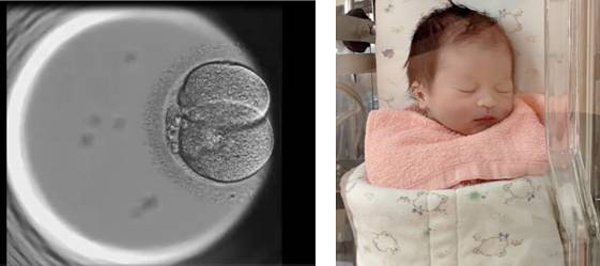 茂盛醫院四代試管-一個良好的胚胎成為一個寶寶