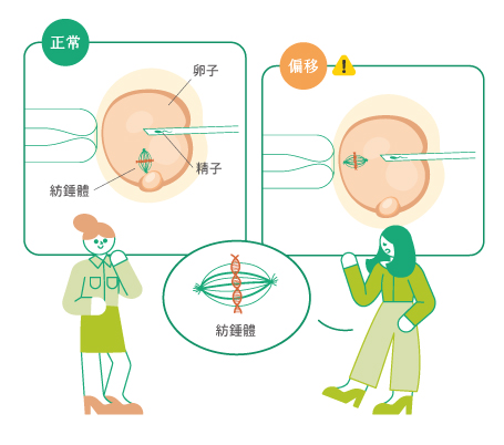 卵子紡錘體定位技術