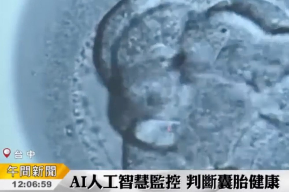 試管嬰兒新技術，AI人工智慧提高懷孕率高達八成