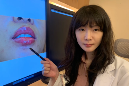 她懶塗口紅花錢紋唇　慘！宋慧喬「減齡豐唇」醜成香腸嘴